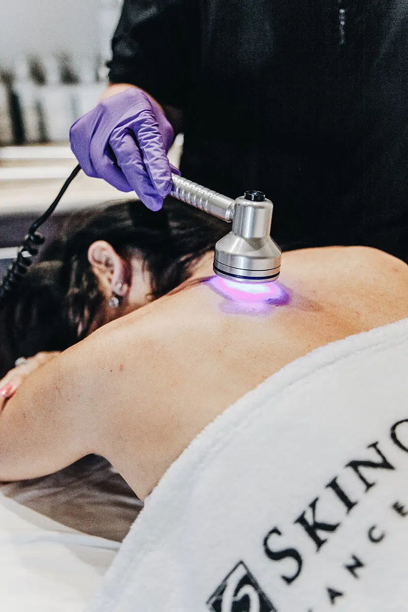 Blue light therapy services
