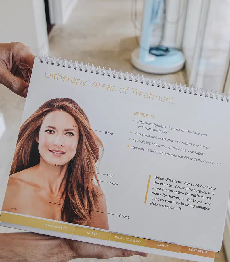 Infographics of Ultherapy areas of treatment