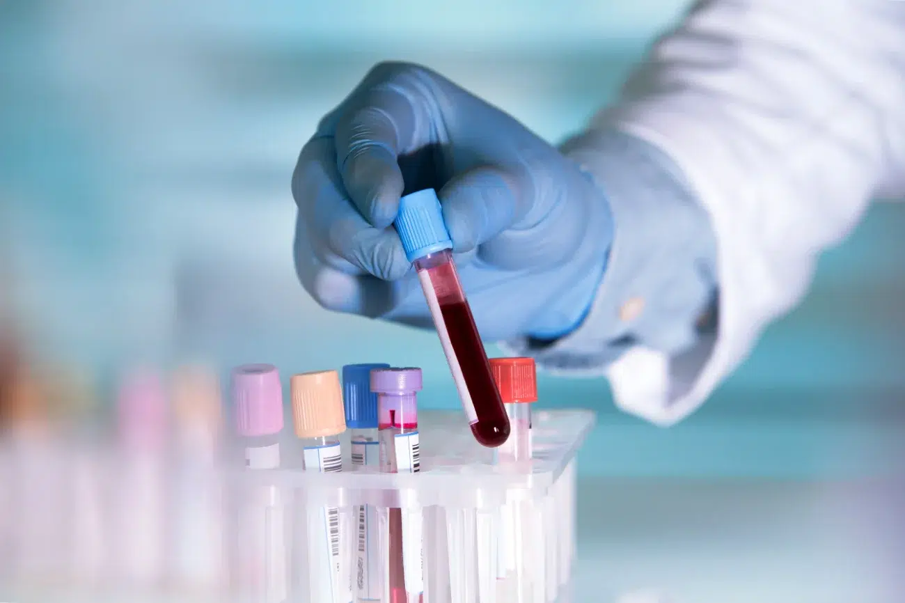 medical employee moving vials of blood for testing medical employee moving vials of blood for testing
