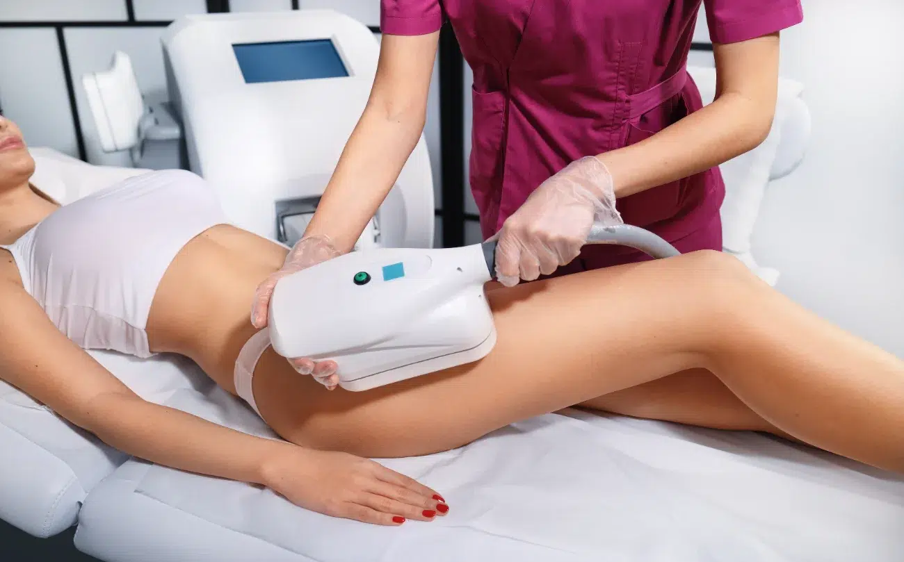 woman getting coolsculpting on her legs
